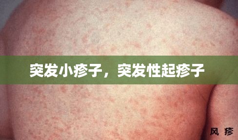布被瓦器 第2页